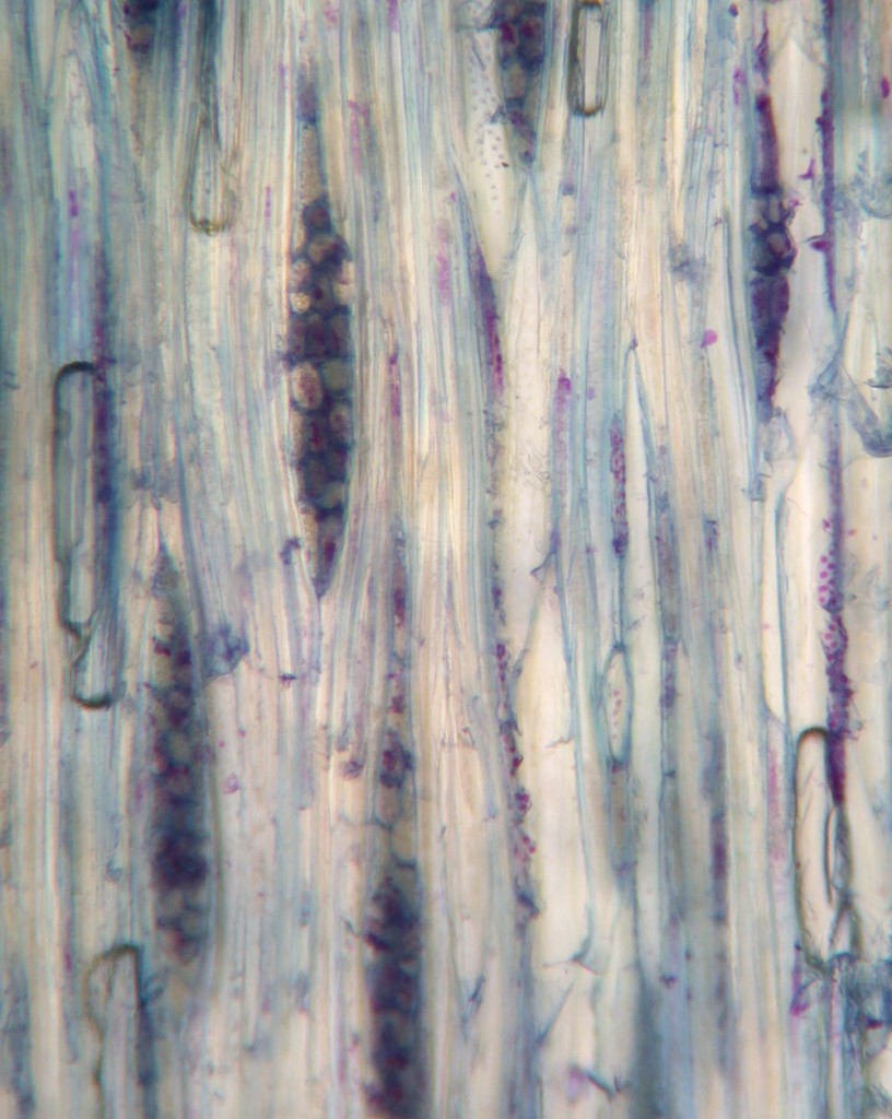 Joyce And Laurens Amazing Sambucus Long Sections Biol Apbi Lab