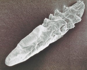 Demodex-mite-scanning-electron-microscope-image-2