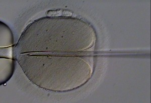 IVF: the insertion of sperm into a human oocyte (egg cell). 