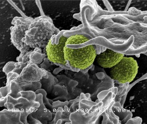 Here is a antibiotic-resistant bacteria which is named MRSA (Methicillin Resistant Staph. Aureus)