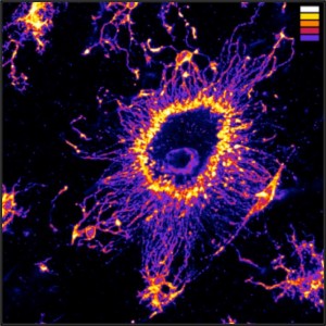 Here is an image of a microglial cell made possible with the SNAPSHOT method