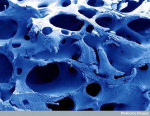 B0004600 Normal bone, SEM Credit: Debbie Marshall. Wellcome Images images@wellcome.ac.uk http://wellcomeimages.org Scanning electron micrograph of normal bone, computer-coloured blue. Scanning electron micrograph 2003 Published: - Copyrighted work available under Creative Commons by-nc-nd 4.0, see http://wellcomeimages.org/indexplus/page/Prices.html
