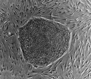 Human_embryonic_stem_cell_colony_phase