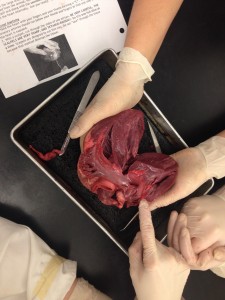 2015-02-13 - Heart Dissection