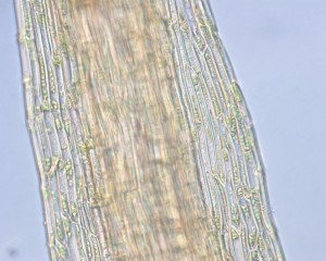 Leptobryum pyriforme leaf cells