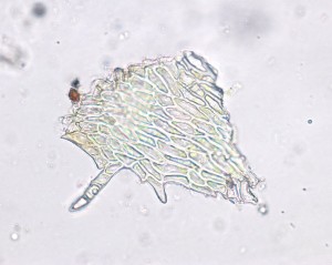 Metaneckera menziesii paraphyllia