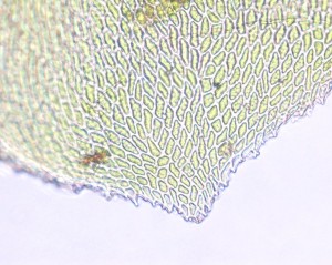 Metaneckera menziesii leaf apex
