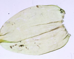 Rhytidiopsis robusta stem leaf proximal