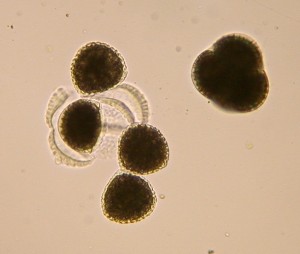 Spores released from the tetrad