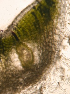 You can easily discern the archegonial wall around this very young sporophyte (not the neck).