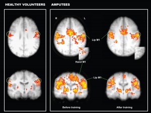 3 images of fMRI scan 
