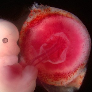 Fetus_and_placenta_-_journal.pbio.0060312.g001