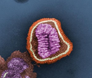 Influenza virus. 