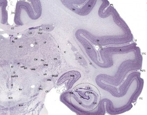 Cerebral Cortex, in dark purple , Source: Wikipedia Commons