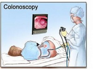 Gastroenterologist performing a colonoscopy on a patient.