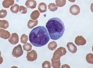 Stained monocytes, a type of white blood cell. Via Wikimedia Commons.