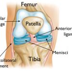The Knee Joint. Articular cartilage is a type of Hyaline cartilage. Image Credit:http: //www.orthoinfo.org/icm/default.cfm?screen=icm005_s02_p1