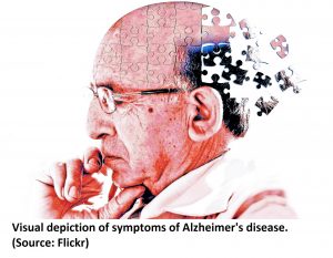 Visual depiction of symptoms of Alzheimer's disease