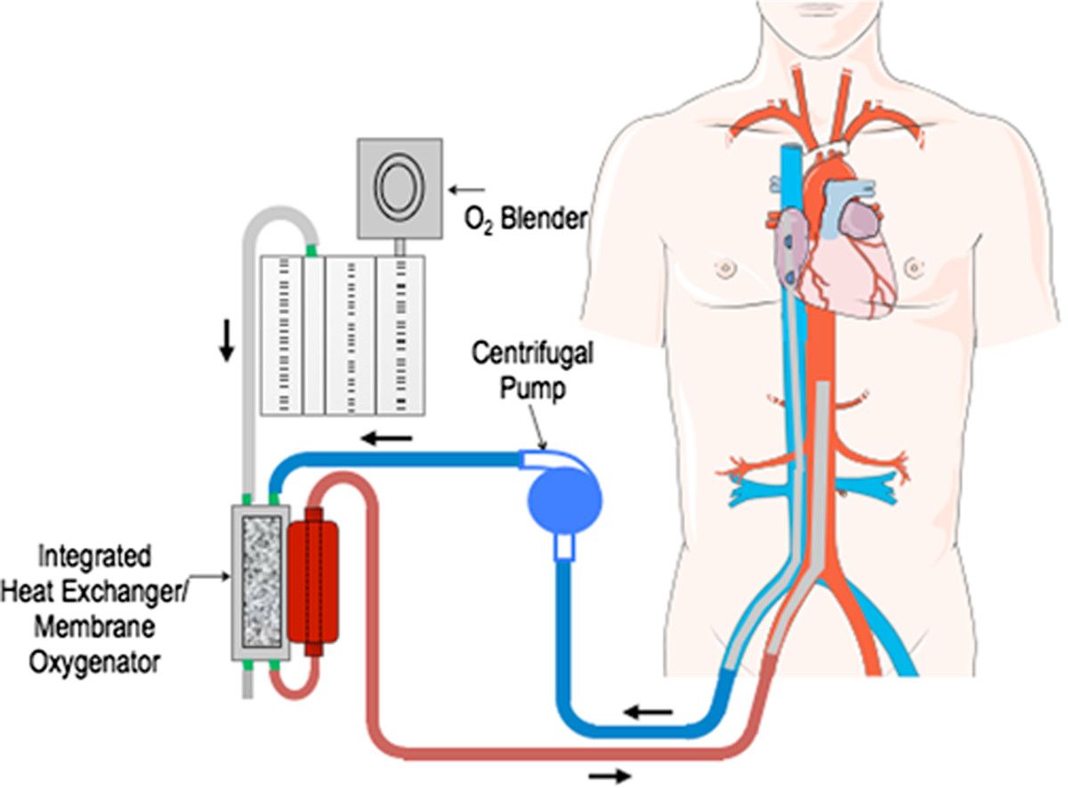 Robot Resuscitation: is it heart patients’ new friend or foe ...