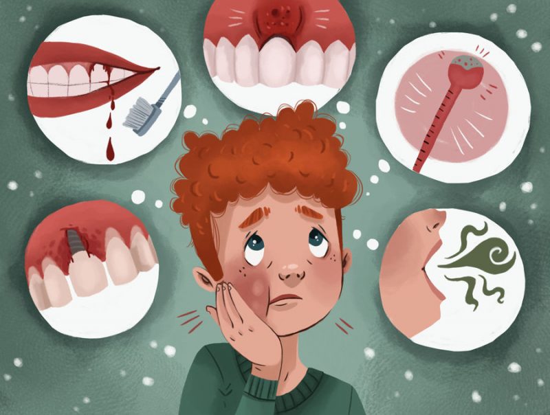 canker-sore-causes-and-risk-factors