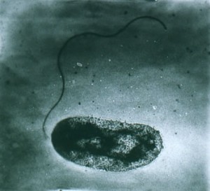 Vibrio vulnificus