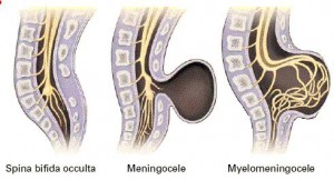 NeuroTube