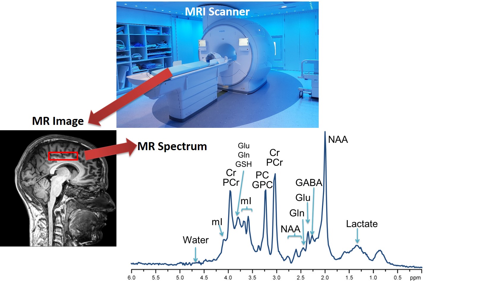 Magnetic Resonance Spectroscopy Research Erin MacMillan | Research ...